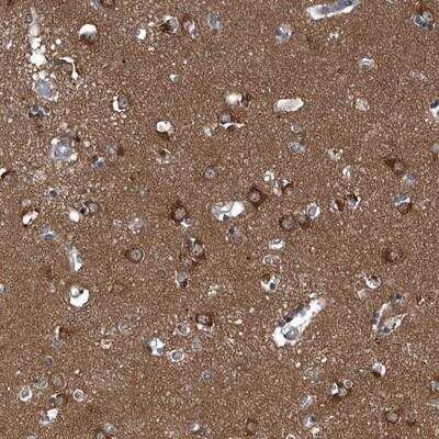 Immunohistochemistry: GAK Antibody [NBP1-86389]