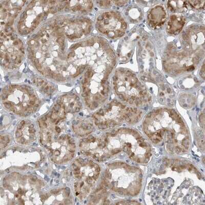 Immunohistochemistry-Paraffin: GAK Antibody [NBP1-89441]