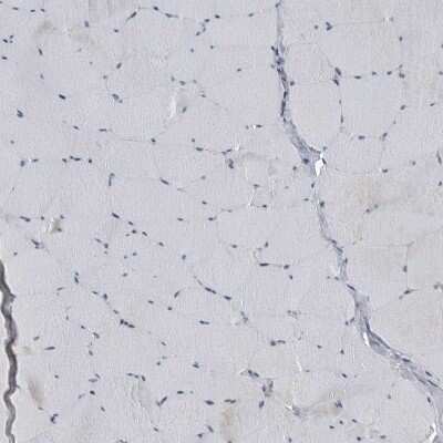 Immunohistochemistry-Paraffin: GAK Antibody [NBP1-89441]