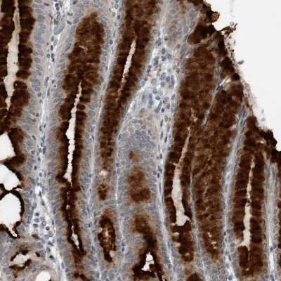 Immunohistochemistry-Paraffin: GAK Antibody [NBP1-89441]