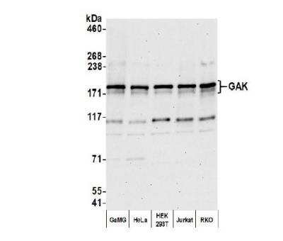 Western Blot: GAK Antibody [NBP2-32181]