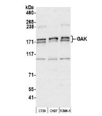 Western Blot: GAK Antibody [NBP2-32181]