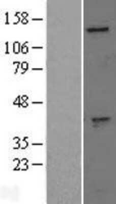 Western Blot: GAK Overexpression Lysate [NBL1-10941]