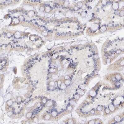 Immunohistochemistry-Paraffin: GAL3ST1 Antibody [NBP1-85431]