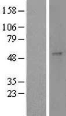 Western Blot: GAL3ST1 Overexpression Lysate [NBL1-10943]