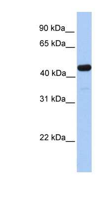 Western Blot: GAL3ST3 Antibody [NBP1-62277]