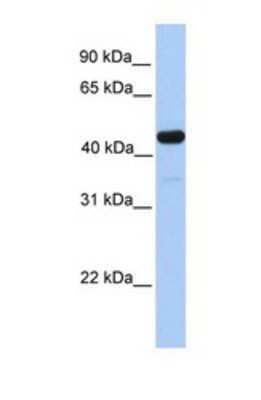 Western Blot: GAL3ST3 Antibody [NBP1-69307]