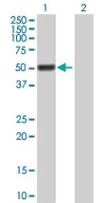 Western Blot: GAL3ST4 Antibody [H00079690-B01P]