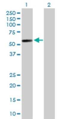 Western Blot: GAL3ST4 Antibody [H00079690-D01P]