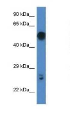 Western Blot: GAL3ST4 Antibody [NBP1-79326]