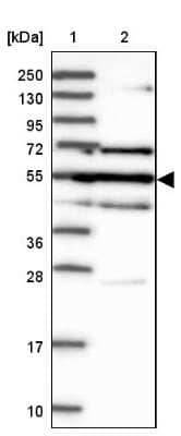 Western Blot: GAL3ST4 Antibody [NBP1-82309]