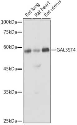 Western Blot: GAL3ST4 AntibodyAzide and BSA Free [NBP3-16522]