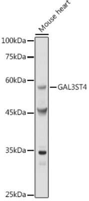 Western Blot: GAL3ST4 AntibodyAzide and BSA Free [NBP3-16522]