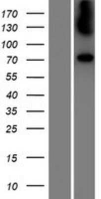 Western Blot: Galactosylceramidase/GALC Overexpression Lysate [NBP2-09050]