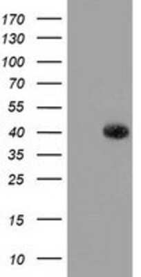 Western Blot: GALE Antibody (OTI1C4) [NBP2-03390]