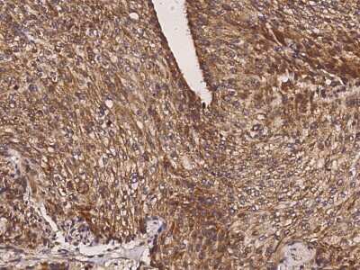 Immunohistochemistry-Paraffin: GALE Antibody [NBP2-96978]