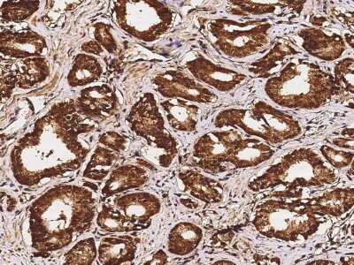 Immunohistochemistry-Paraffin: GALE Antibody [NBP2-96978]