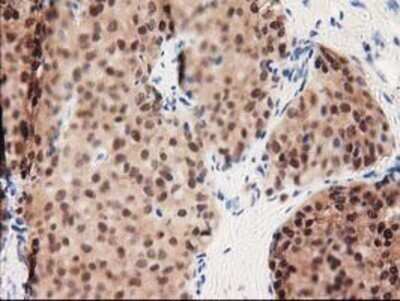 Immunohistochemistry: GALE Antibody (OTI1C4) - Azide and BSA Free [NBP2-70793]