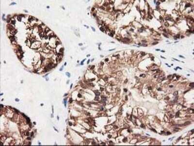 Immunohistochemistry: GALE Antibody (OTI1C4) - Azide and BSA Free [NBP2-70793]