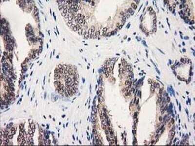 Immunohistochemistry: GALE Antibody (OTI1C4) - Azide and BSA Free [NBP2-70793]