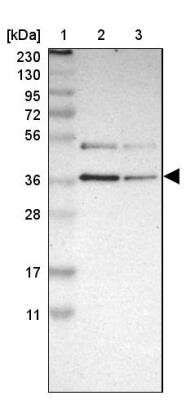 Western Blot: GALE Antibody [NBP1-87066]