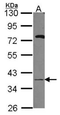 Western Blot: GALE Antibody [NBP2-16579]