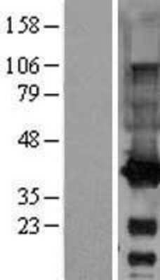 Western Blot: GALE Overexpression Lysate [NBL1-10946]