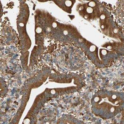 Immunohistochemistry-Paraffin: GALK1 Antibody [NBP1-81853]
