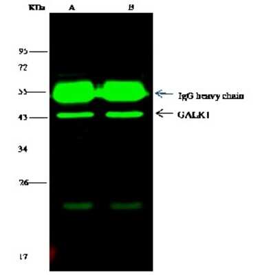 Immunoprecipitation: GALK1 Antibody [NBP2-99783]