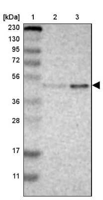 Western Blot: GALK1 Antibody [NBP1-81853]
