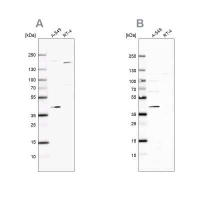 Western Blot: GALK1 Antibody [NBP1-81853]