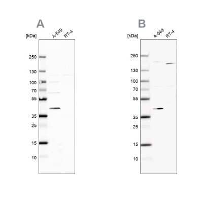 Western Blot: GALK1 Antibody [NBP1-81854]