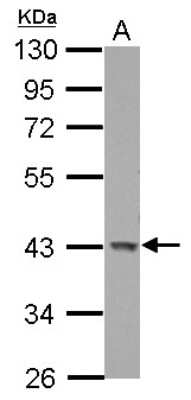 Western Blot: GALK1 Antibody [NBP2-16591]