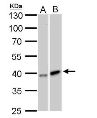 Western Blot: GALK1 Antibody [NBP2-16591]