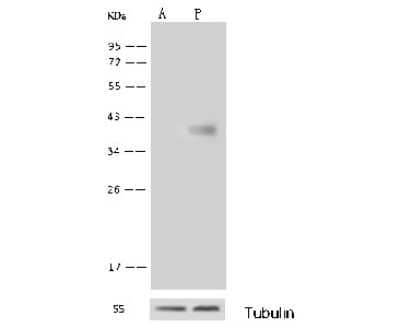 Western Blot: GALK1 Antibody [NBP2-99783]