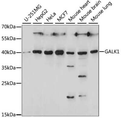 Western Blot: GALK1 AntibodyAzide and BSA Free [NBP3-04421]