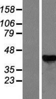 Western Blot: GALK1 Overexpression Lysate [NBP2-09051]