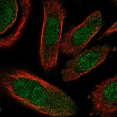 Immunocytochemistry/ Immunofluorescence: GALK2 Antibody [NBP2-48900]