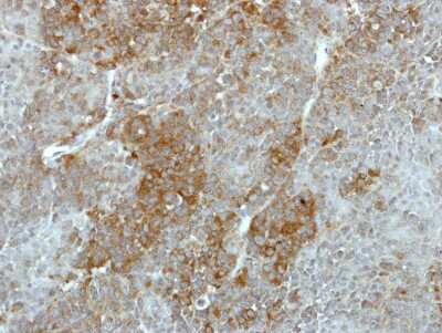 Immunohistochemistry-Paraffin: GALK2 Antibody [NBP1-33401]
