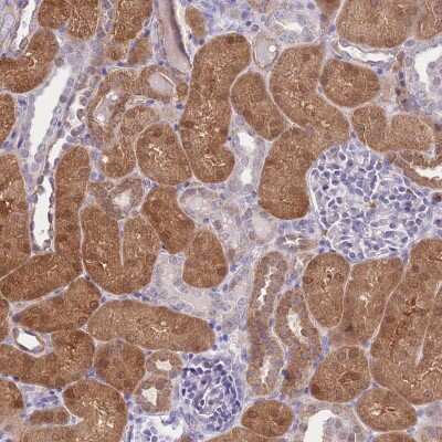 Immunohistochemistry-Paraffin: GALK2 Antibody [NBP2-48900]