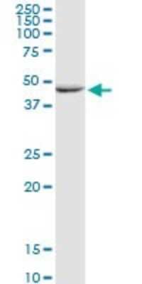 Western Blot: GALK2 Antibody [H00002585-D01P]