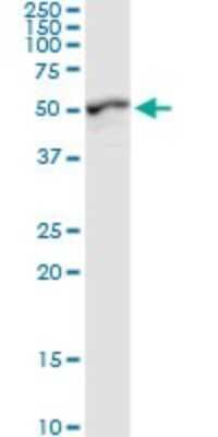 Western Blot: GALK2 Antibody [H00002585-D01P]