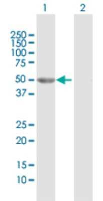 Western Blot: GALK2 Antibody [H00002585-D01P]