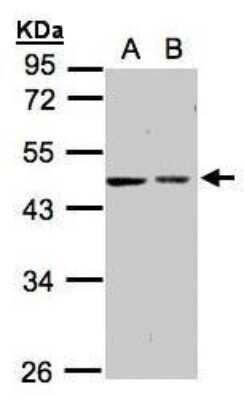 Western Blot: GALK2 Antibody [NBP1-32508]