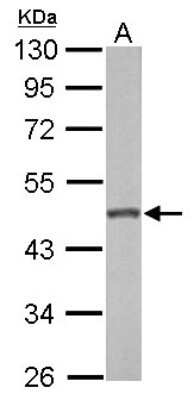 Western Blot: GALK2 Antibody [NBP1-33401]