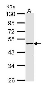 Western Blot: GALK2 Antibody [NBP1-33401]