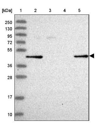 Western Blot: GALK2 Antibody [NBP2-48900]