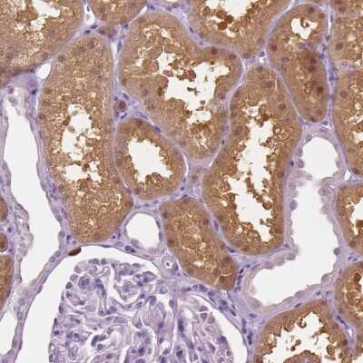 Immunohistochemistry-Paraffin: GALM Antibody [NBP1-85906]