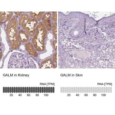 Immunohistochemistry-Paraffin: GALM Antibody [NBP1-85906]