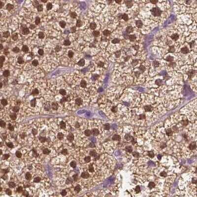 Immunohistochemistry-Paraffin: GALM Antibody [NBP1-85906]